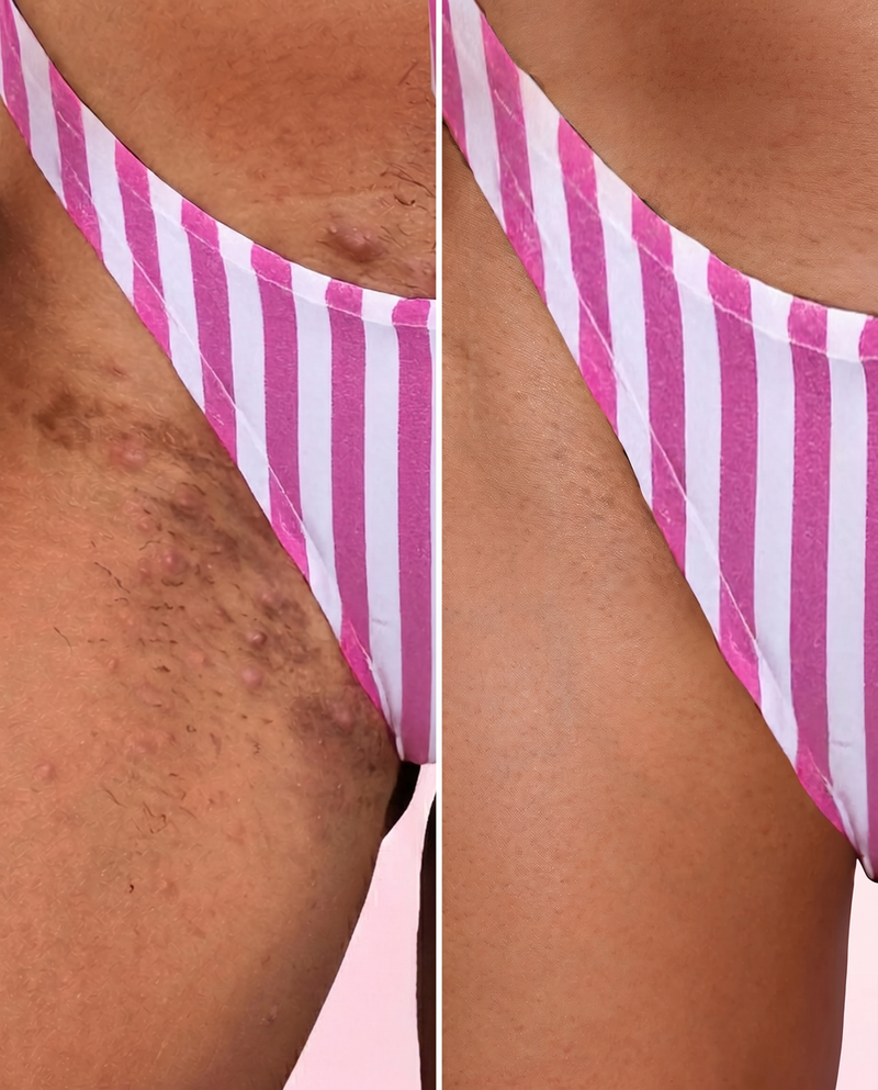 antes-depois-bl-main-ezgif.com-optipng.png__PID:e054cff4-109d-47e1-b711-9c51d2655e44