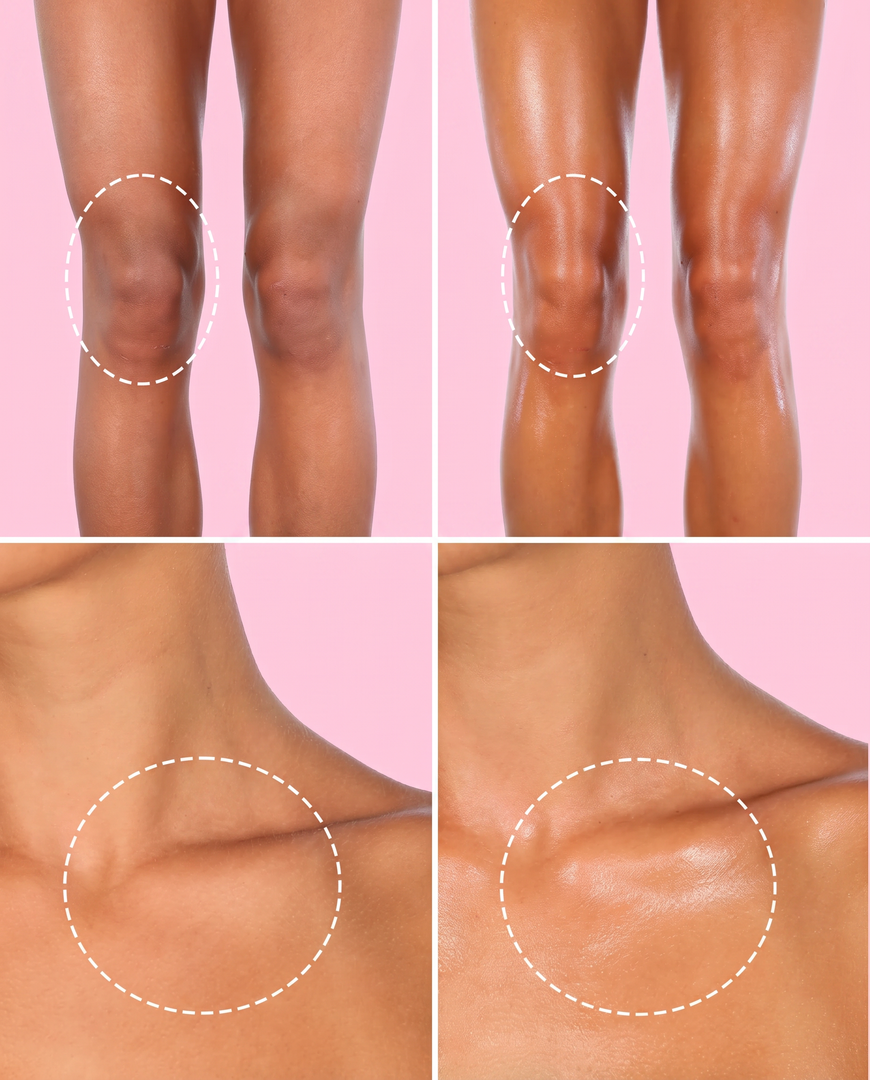 Bella Skin: El Secreto para Aclarar Axilas, Entrepierna y Zona Íntima + Envío GRATIS
