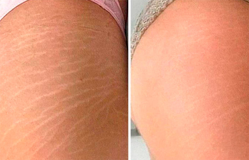 pieldecrystal-review.jpg__PID:cee92e60-735a-4259-9dcd-73f3c258765f